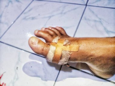 Adamın bacağındaki kanayan yara bandajlarla kaplıydı. Yara bakımı için yama. Güvenlik. Acı.