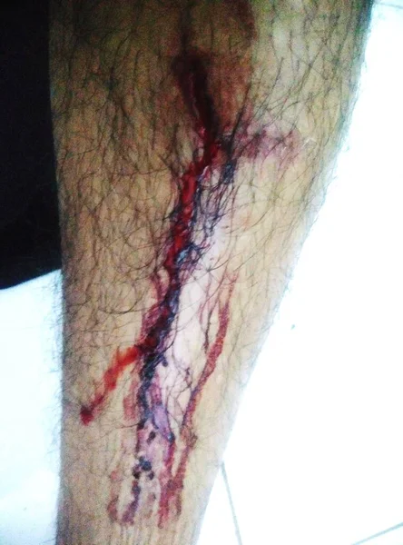 那人的脚是血红色的 他撕破了他的黑色裤子 因为他在高速公路上从摩托车上摔了下来 — 图库照片
