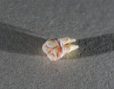 Uzun süre acı çektikten sonra, kendi kendine düştü..