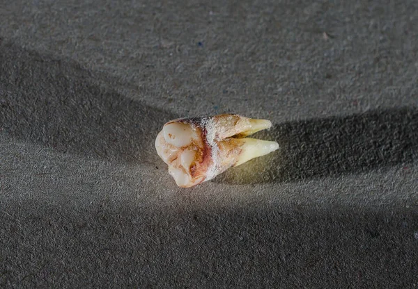 A bad teeth has fallen by itself