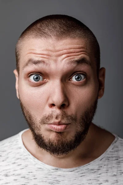 Retrato de jovem surpreso — Fotografia de Stock