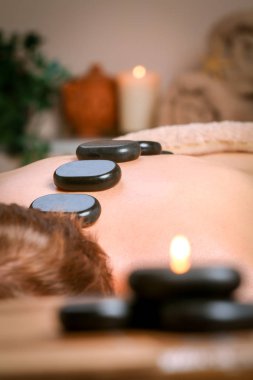 Genç alan omuz ahbap ve Masaj terapist Spa arka