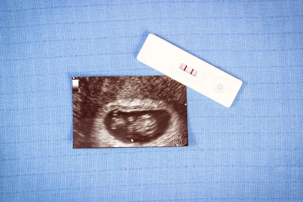 Pregnancy test with positive result and ultrasound scan of baby on background of diapers, concept of extending family and expecting for baby