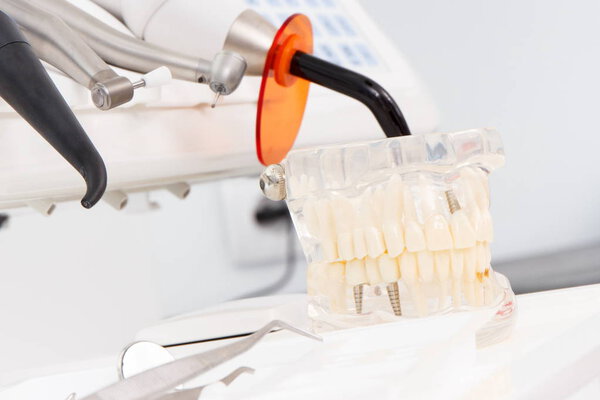 Dental jaw model, accessories, tools and instruments used by dentists in modern stomatology office