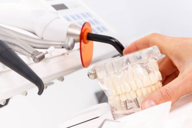 Diş hekiminin eli diş çene modeli, stomatoloji ofisinde kullanılan araçlar