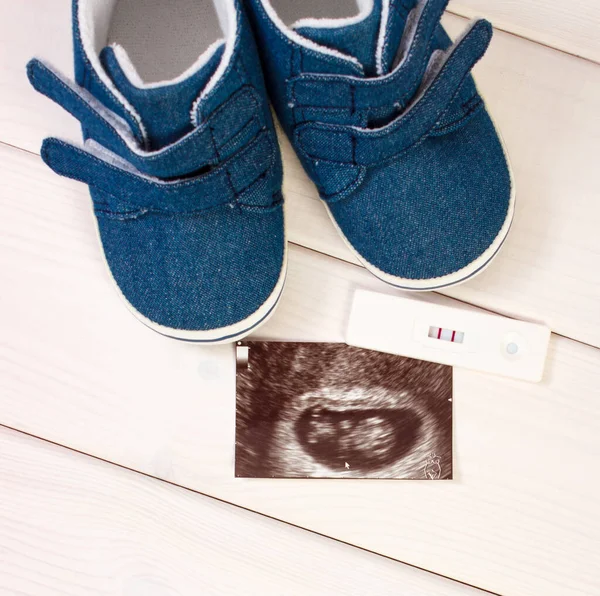 Zwangerschapstest Met Positief Resultaat Ultrasone Scan Van Baby Baby Schoenen — Stockfoto