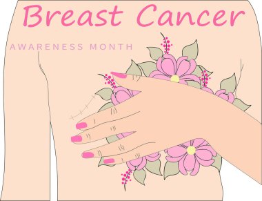  Ya da göğüs kanseri için çiçekli bir mastektomi. Kadın göğüslerini çiçeklerle kaplıyor. Göğüs kanseri yarası. Göğüs kanseri farkındalığı vektör çizimi. Poster tasarımı 