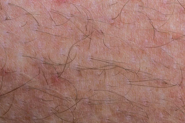 Detail Kulit Manusia Dengan Rambut Close Makro — Stok Foto