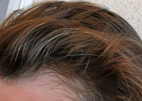 Graue Strähnen Haar Brauchen Friseur — Stockfoto