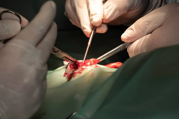 Zespół Chirurgiczny Białych Rękawiczkach Trzyma Przyrządy Medyczne Podczas Wykonywania Skomplikowanych — Zdjęcie stockowe
