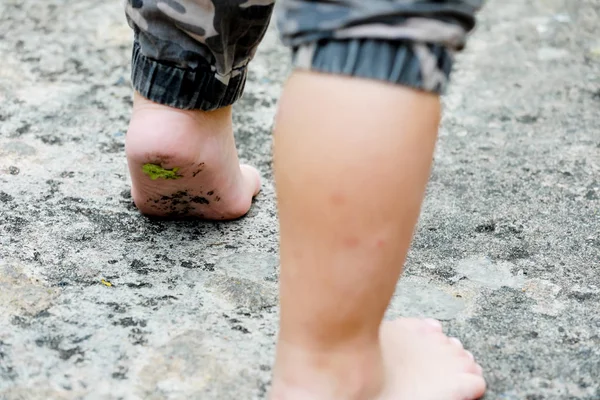 Pies Desnudos Los Pies Del Niño Usan Zapatos Piso Hormigón — Foto de Stock