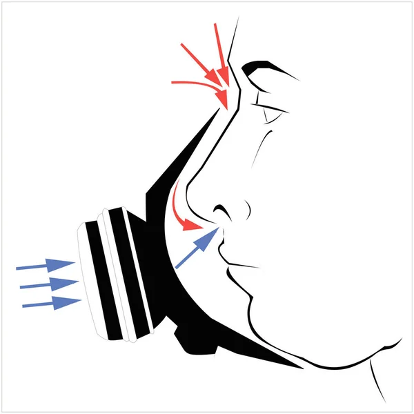 Vectorillustratie Van Correcte Onjuiste Luchtdoorgang Door Een Ademhalingsapparaat — Stockvector