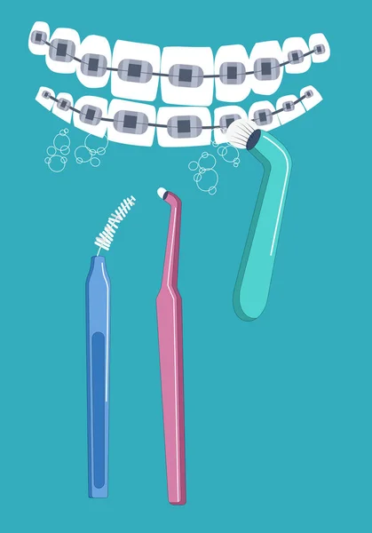 Cavidade Oral Higiene Vida Diária Ilustração Cuidados Aparelhos Dentários Dentes —  Vetores de Stock