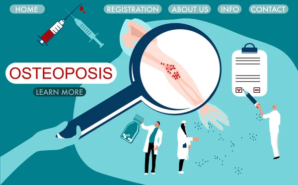 Dünya Osteoporoz Günü Konsepti Kırılgan Gözenekli Kırılgan Kemikli Büyüteç Küçük — Stok Vektör