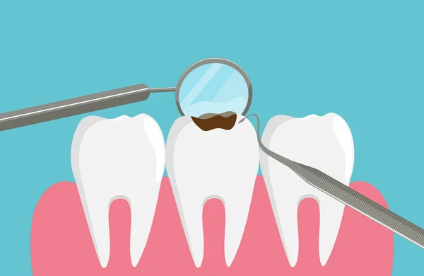 Exame dentário, dentes e instrumentos em estilo plano, ilustração vetorial estoque. — Vetor de Stock