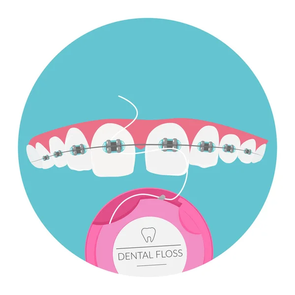 Cuidados dentários diários para aparelhos, higiene oral com fio dental, ilustração vetorial. —  Vetores de Stock