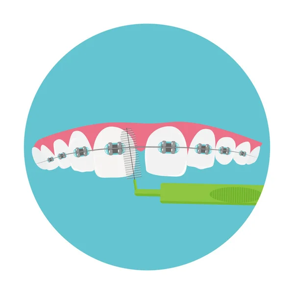 Daglig tandvård för tandställning, munhygien med speciell borste, vektor illustration. — Stock vektor