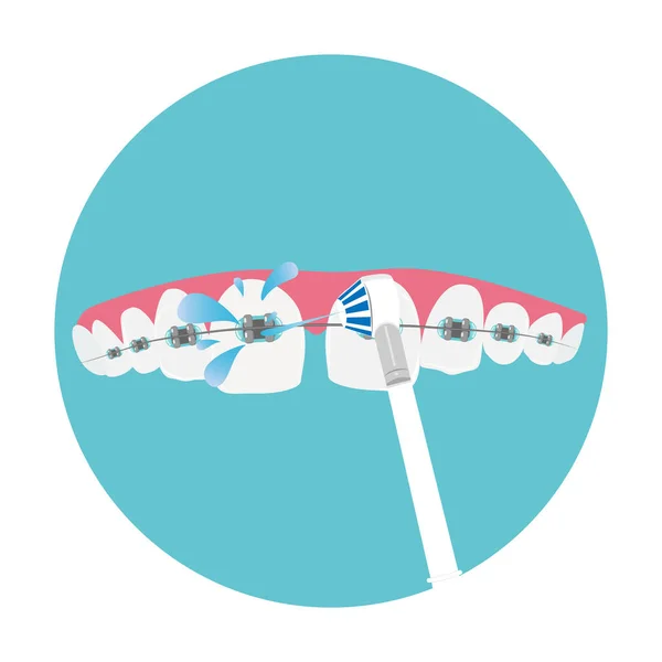 Cuidados dentários diários para aparelhos, higiene oral, conceito de ortodontia, ilustração vetorial. — Vetor de Stock