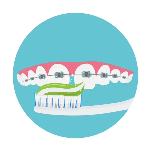 Daglig tandvård för tandställning, munhygien, tandreglering koncept, vektor illustration. — Stock vektor