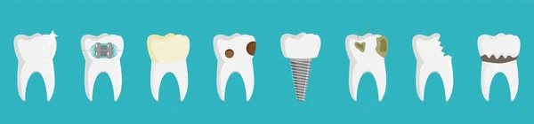 Conjunto de dentes, saudável e witn diferentes problemas dentários, ilustração vetor estoque. — Vetor de Stock