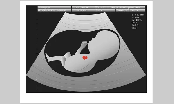 Ultrassom do feto no útero materno, conceito médico, ilustração vetorial. — Vetor de Stock