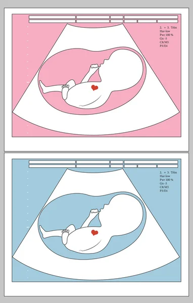 Ultrasound bayi yang belum lahir di rahim ibu, laki-laki atau perempuan, konsep medis, ilustrasi vektor. - Stok Vektor