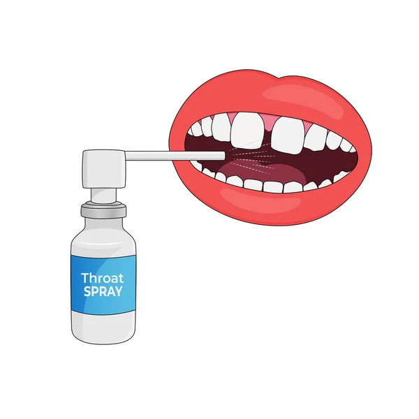 Oral, frasco de pulverização garganta pulverização na boca, ilustração vetor. — Vetor de Stock