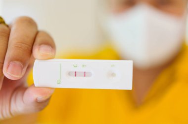 Uyuşturucu testi, elinde bir şişe idrar örneği tutan adam, tıbbi analiz.