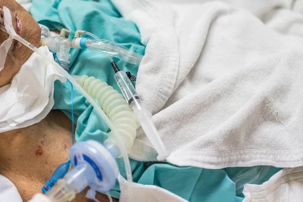 Hasta Asyalı yaşlı kadınlar 80s trakeostomi kullanım havalandırma için Yardım Hastanesi yoğun bakım ünitesi (yoğun bakımda.) odadaki hasta yatağı üzerinde nefes solunum yapmak.