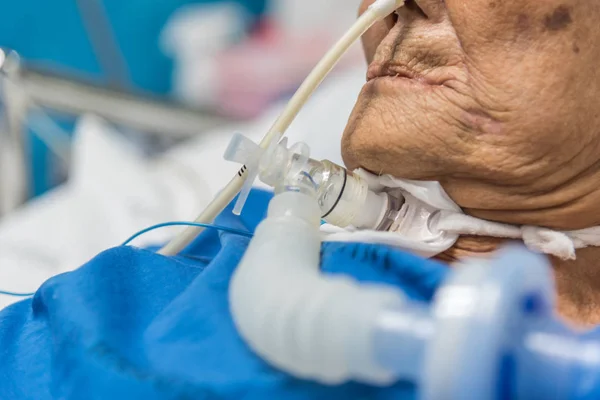 患者アジア高齢者女性 年代は気管カニューレ使用人工呼吸器呼吸呼吸の病院で集中治療室 Icu 室で患者のベッドの上の助けのため — ストック写真