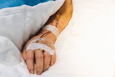 Hastanesi yoğun bakım ünitesi (yoğun bakımda.) odadaki hasta yatağı üzerinde hasta Asya yaşlı kadınlarla 80s tuzlu Intravenous C-line veya yaşlı bir hasta üzerinde A-line, el.