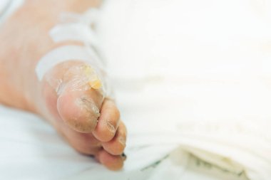 Hasta Asya yaşlı kadınlarla 80s serum C-line veya A-line, intravenöz bir yaşlı hasta üzerinde taban Hastanesi yoğun bakım ünitesi (yoğun bakımda.) odadaki hasta yatağı üzerinde ayak.