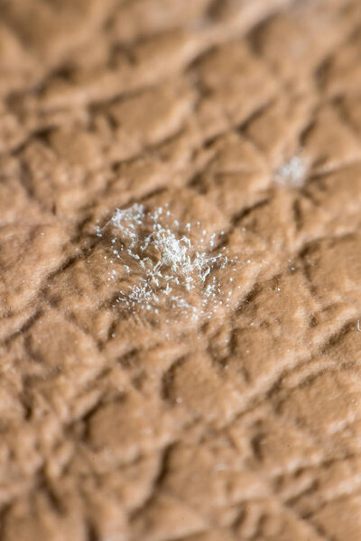 Mold Spores grown on the skin of the leather
