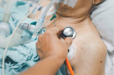 Doktor, grip için steteskop kullanıyor. Kovid19, korona virüsü, CRE. Ya da VRE. 80 yaşındaki yaşlı hasta yoğun bakımda hasta yatağında yatıyor. (Yoğun bakımda) Hastanedeki oda