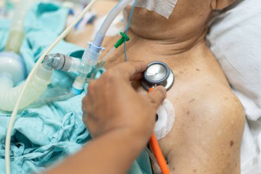 Doktor, grip için steteskop kullanıyor. Kovid19, korona virüsü, CRE. Ya da VRE. 80 yaşındaki yaşlı hasta yoğun bakımda hasta yatağında yatıyor. (Yoğun bakımda) Hastanedeki oda