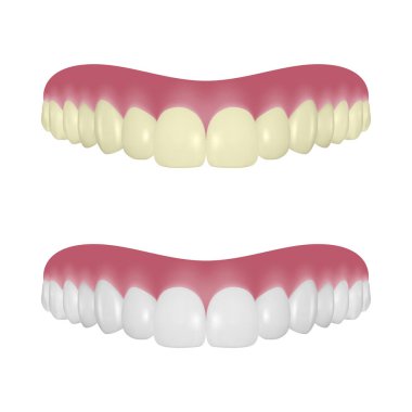 Vektör 3d Gerçekçi Render Protez Seti Closeup Beyaz Arka Plan üzerinde izole. Diş Hekimliği ve Ortodonti Tasarımı. Tıbbi ve Diş Macunu Kavramı için İnsan Dişleri. Sağlıklı Ağız Hijyeni, Çene Protezi