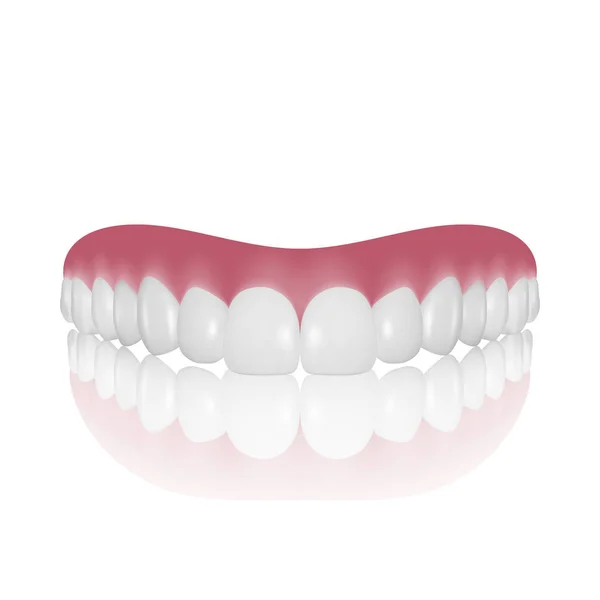 Vector 3d Realistic Render Denture Closeup Isolado em fundo branco. Odontologia e Ortodontia Design. Dentes Humanos para Conceito Médico e Pasta Dentária. Higiene Oral Saudável, Prótese da mandíbula —  Vetores de Stock