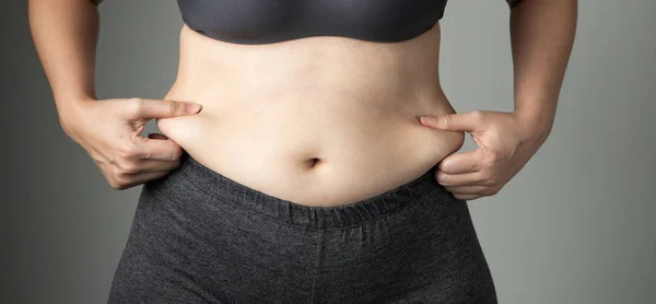 Gordura Mulher Celulite Barriga Insalubre — Fotografia de Stock