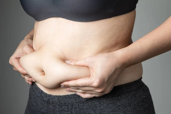 Gordura Mulher Celulite Barriga Insalubre — Fotografia de Stock