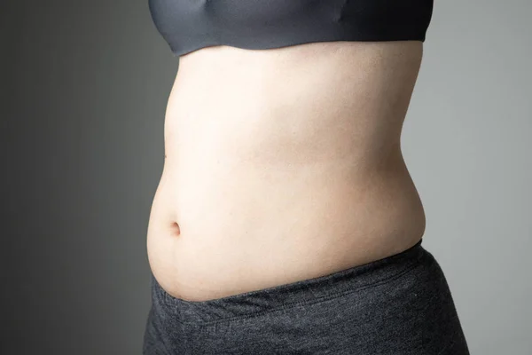 Gordura Mulher Celulite Barriga Insalubre — Fotografia de Stock