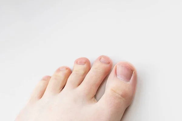 Zbliżenie Żeńskich Nóg Palców Paznokci Bez Pedicure Podstawa Manicure Przestrzeń — Zdjęcie stockowe