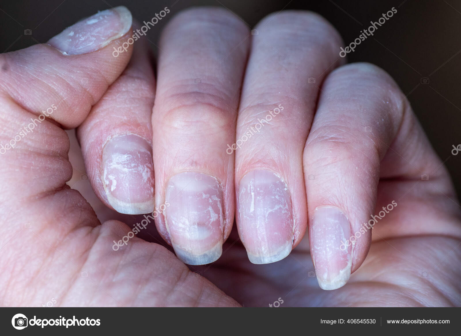 Ногти После Геля Фото