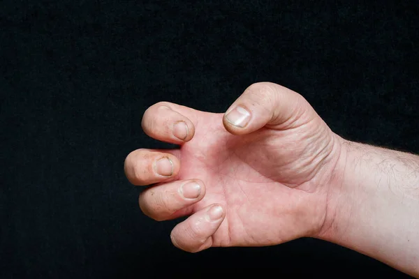 近视的短指甲肮脏 白种人的手在黑色背景 焦虑不安的指甲概念 原始天然指甲 男性指甲 — 图库照片