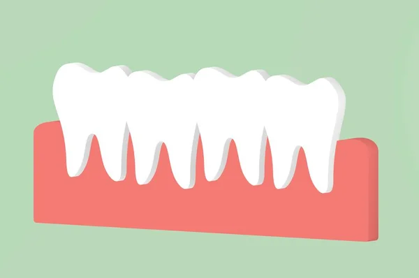Apinhamento Dentes Oclusão Desenho Animado Dental Renderizar Caráter Bonito Estilo — Fotografia de Stock