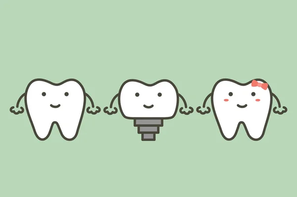 Zubní Implantát Zuby Změna Nový Kořen Přátelé Zubní Kreslené Vektorové — Stockový vektor