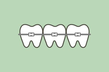 ortodontik diş ya da diş diş teli - diş çizgi film vektör düz stil şirin karakter tasarımı için