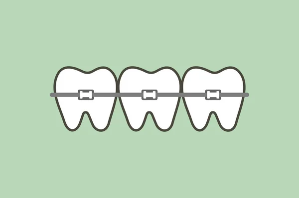 Dentes Ortodônticos Aparelho Dentário Dente Desenho Animado Vetor Estilo Plano — Vetor de Stock