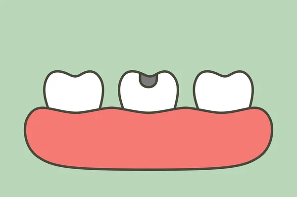 Çürük Diş Diş Çürüğü Diş Çizgi Film Düz Stil Şirin — Stok Vektör