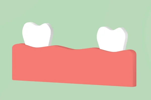 Brakujących Zębów Przestrzeni Pomiędzy Zębami Ustach Dental Render Płaski Cute — Zdjęcie stockowe