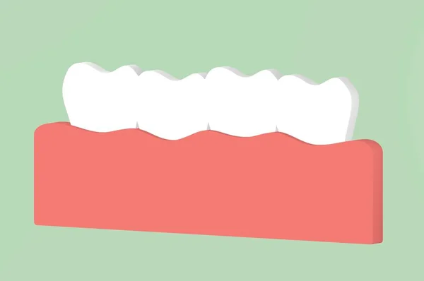 Enge Zähne Malokklusion Zahnärztliche Cartoon Rendering Flachen Stil Niedlichen Charakter — Stockfoto